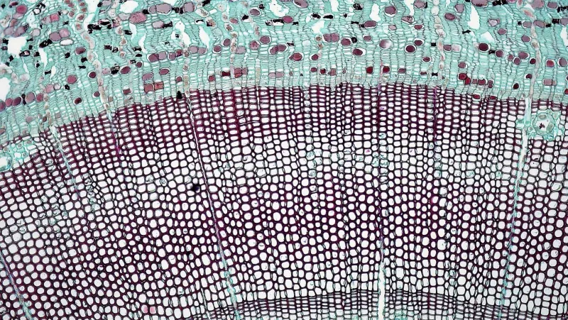 More Than a Breathing Muscle: The Diaphragm's Commanding Role in Digestion, Stress, and Systemic Health